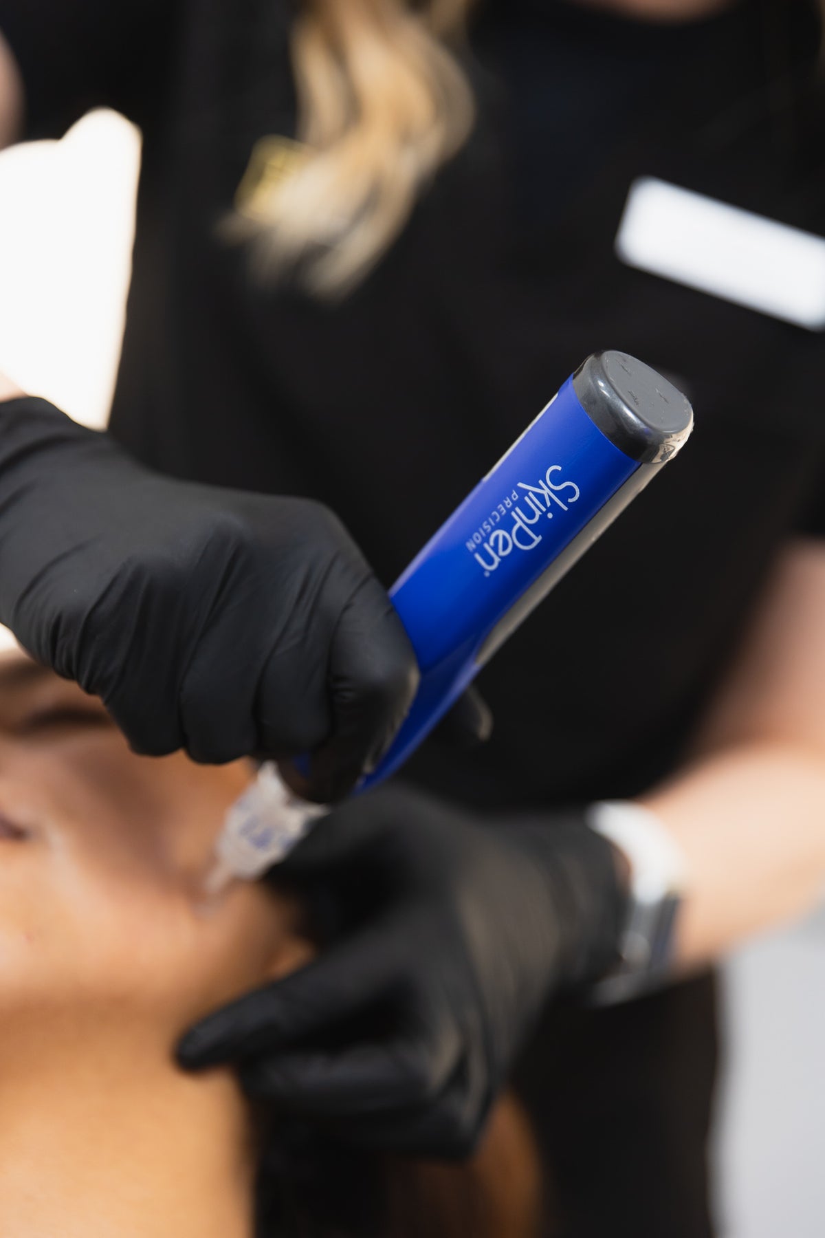 SkinPen Microneedling